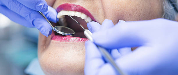 Best Emergency Dental Care for Broken or Chipped Teeth in Winfield, KS